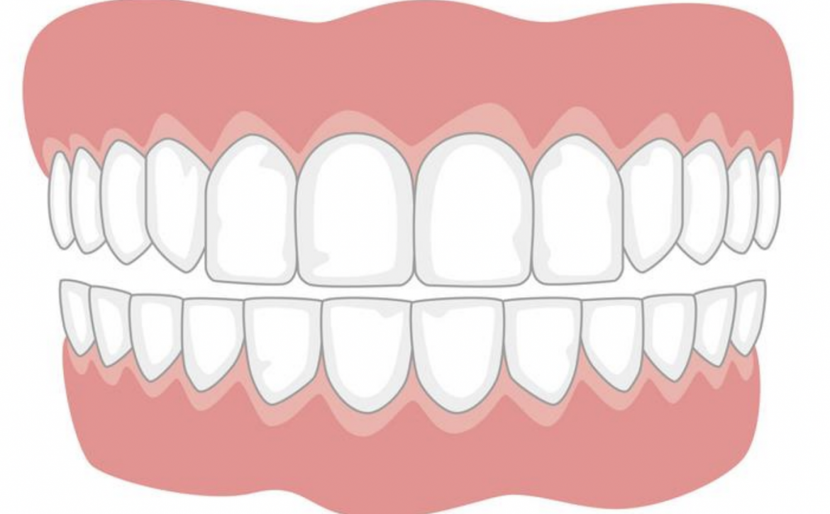 Picture of teeth